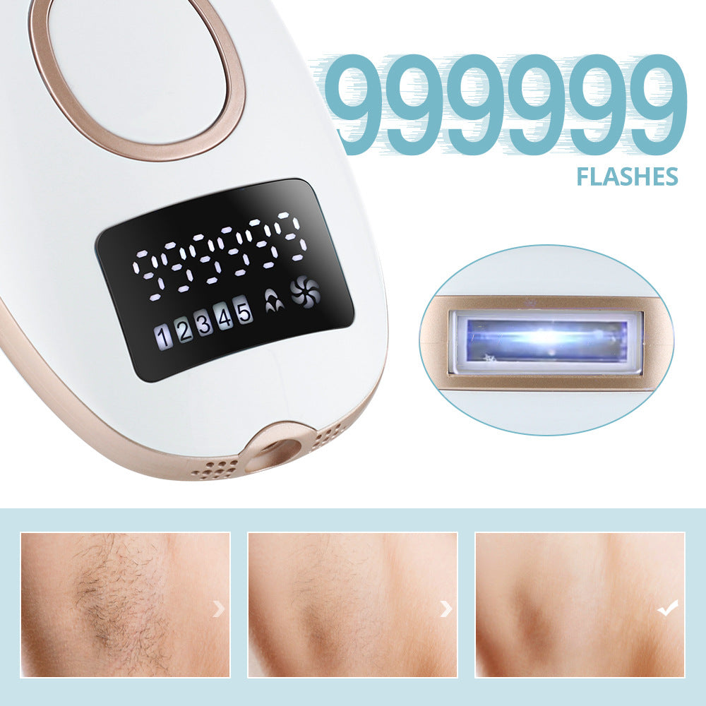 Laser Hair Removal